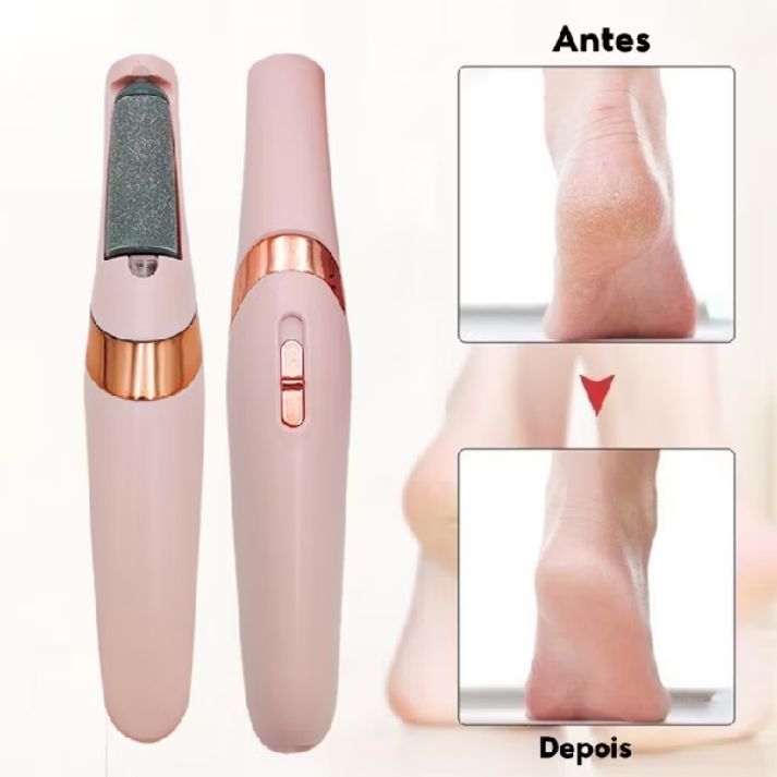 Foot Callus Remover